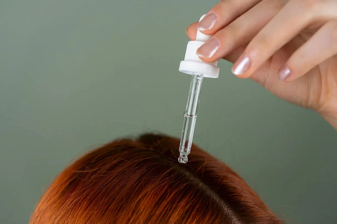 Close-up view of human scalp showing thinning hair and hair loss patterns on top of head